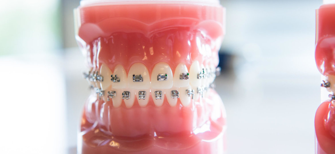 Freeman Orthodontics - Braces Treatment-37
