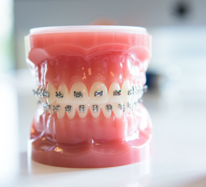 Freeman-Orthodontics-Braces-Treatment-37-thegem-gallery-justified  - Braces and Invisalign in San Jose California - Freeman Orthodontics