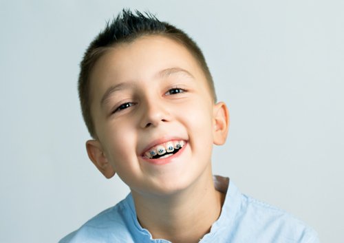 wpid-ortho-treatment-young-age  - Braces and Invisalign in San Jose California - Freeman Orthodontics