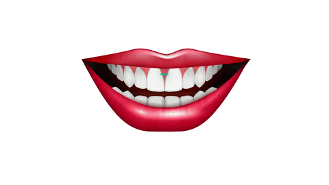 matt-freeman-orthodontics-smile-width-adjustedb  - Braces and Invisalign in San Jose California - Freeman Orthodontics