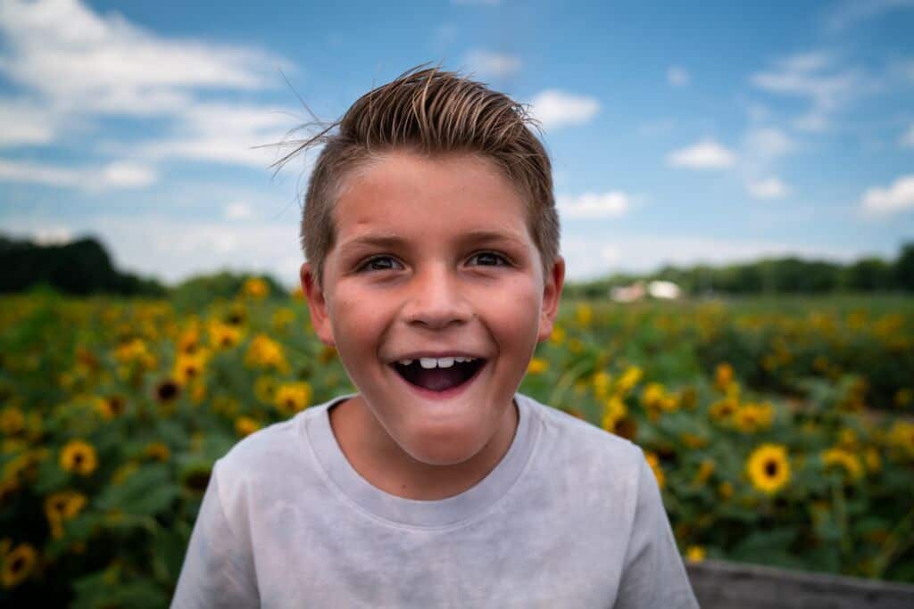 Braces Before And After Buck Teeth